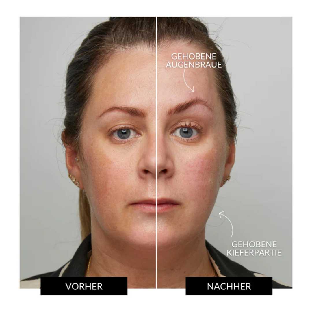Face io - Glätten, Straffen, Reinigen: für strahlende Haut