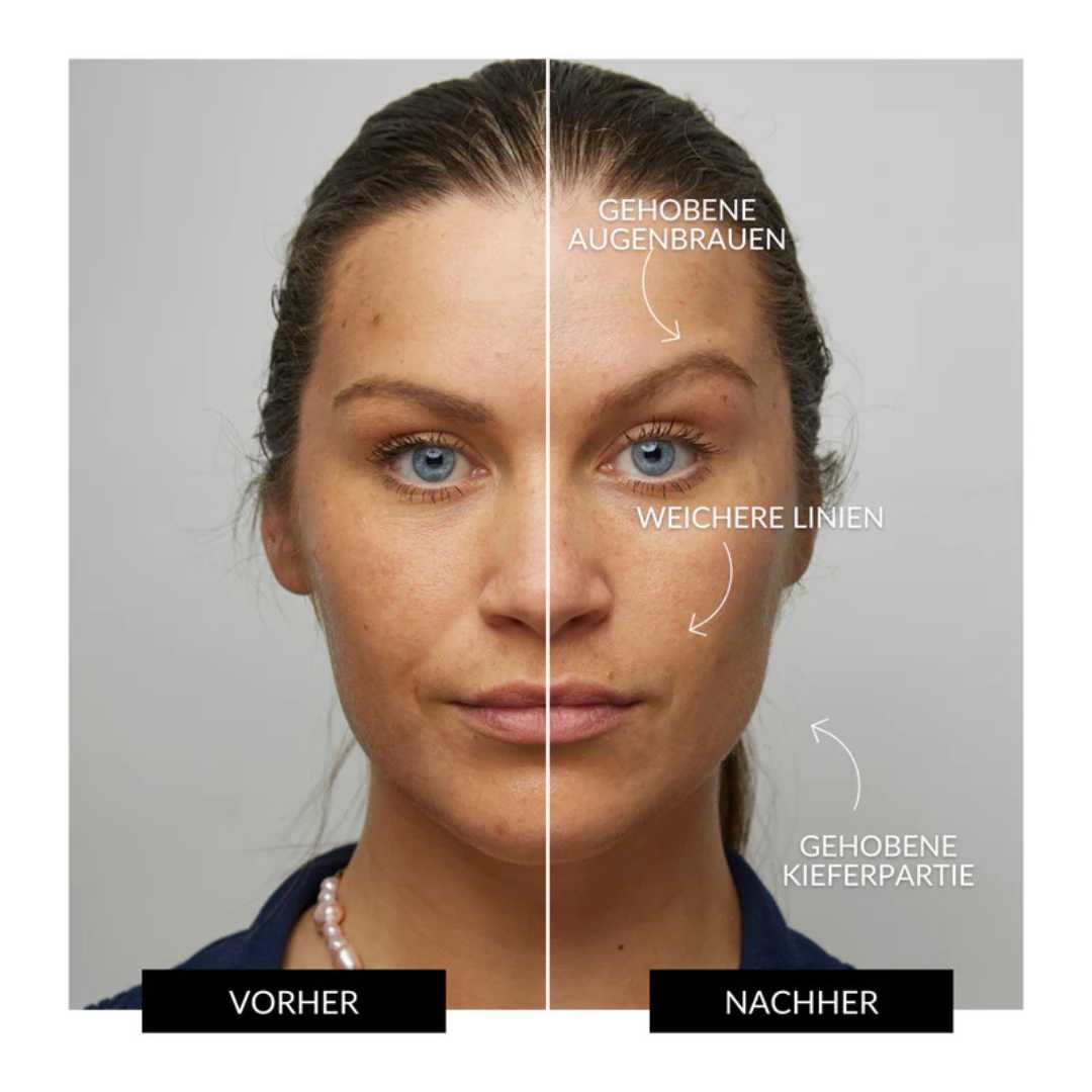 Face io - Glätten, Straffen, Reinigen: für strahlende Haut