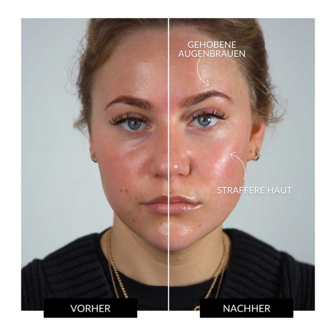 Face io - Glätten, Straffen, Reinigen: für strahlende Haut