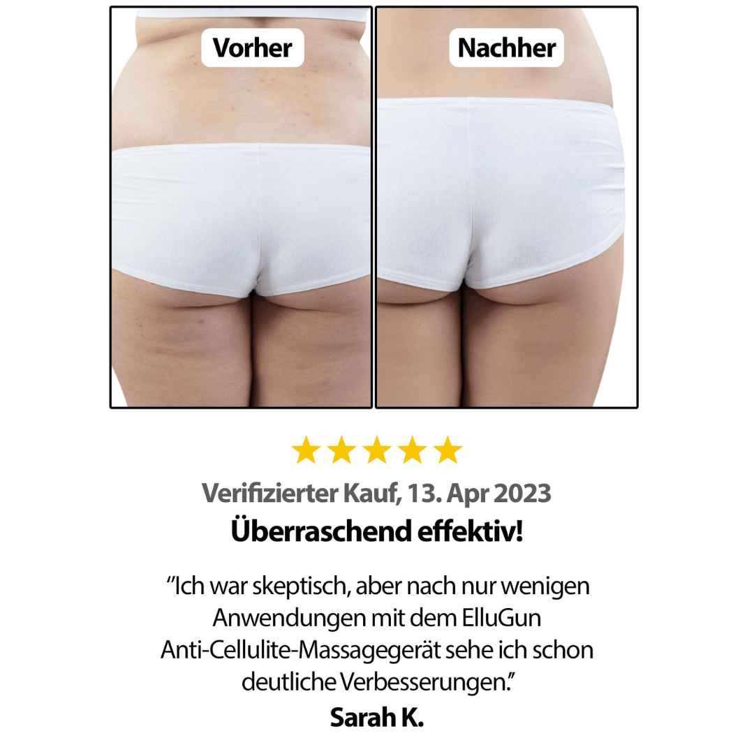 Cellugone 3.0 - Dauerhaft glatte & straffe Haut