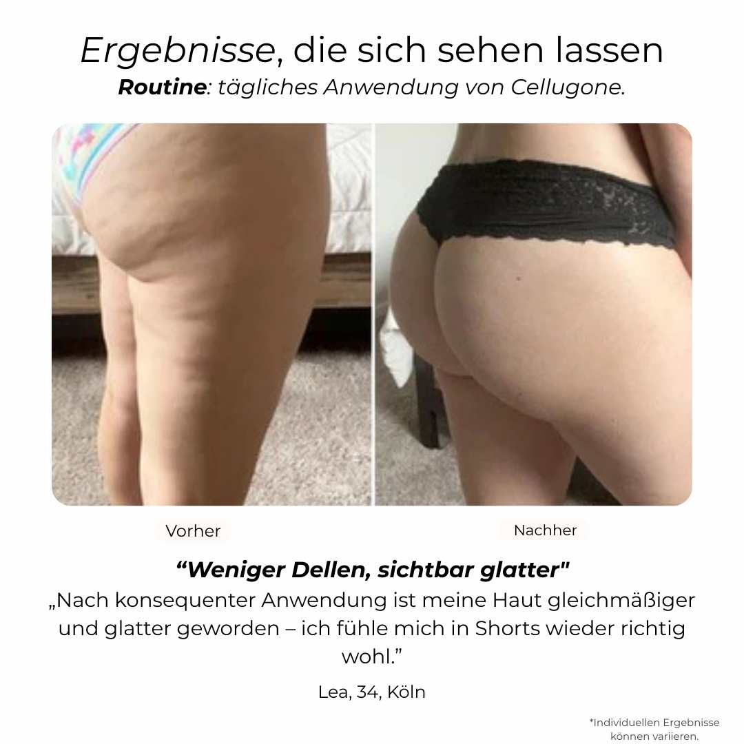 Cellugone 3.0: Glättet Cellulite und strafft Bauch, Beine & Po für zuhause
