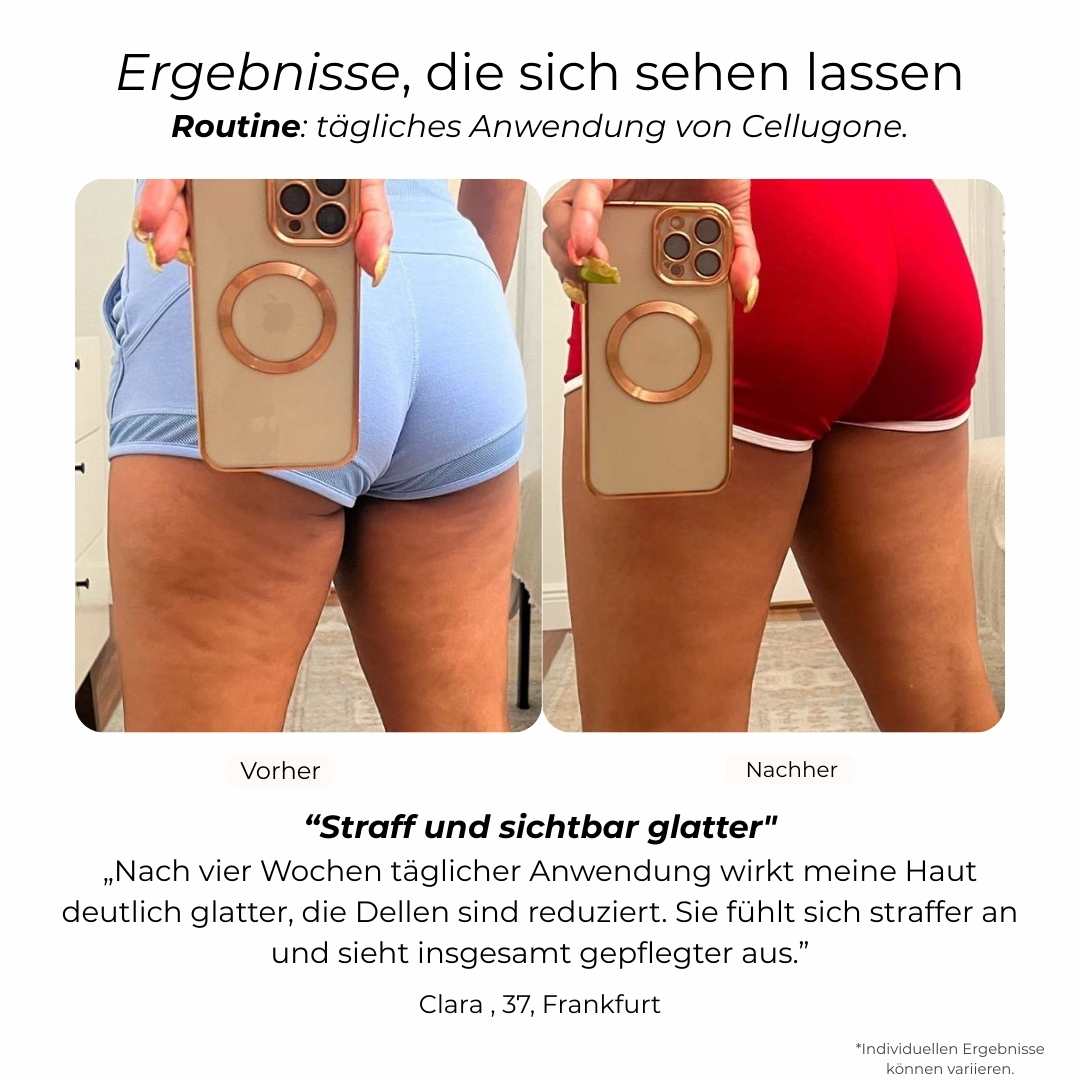 Cellugone 3.0: Glättet Cellulite und strafft Bauch, Beine & Po für zuhause