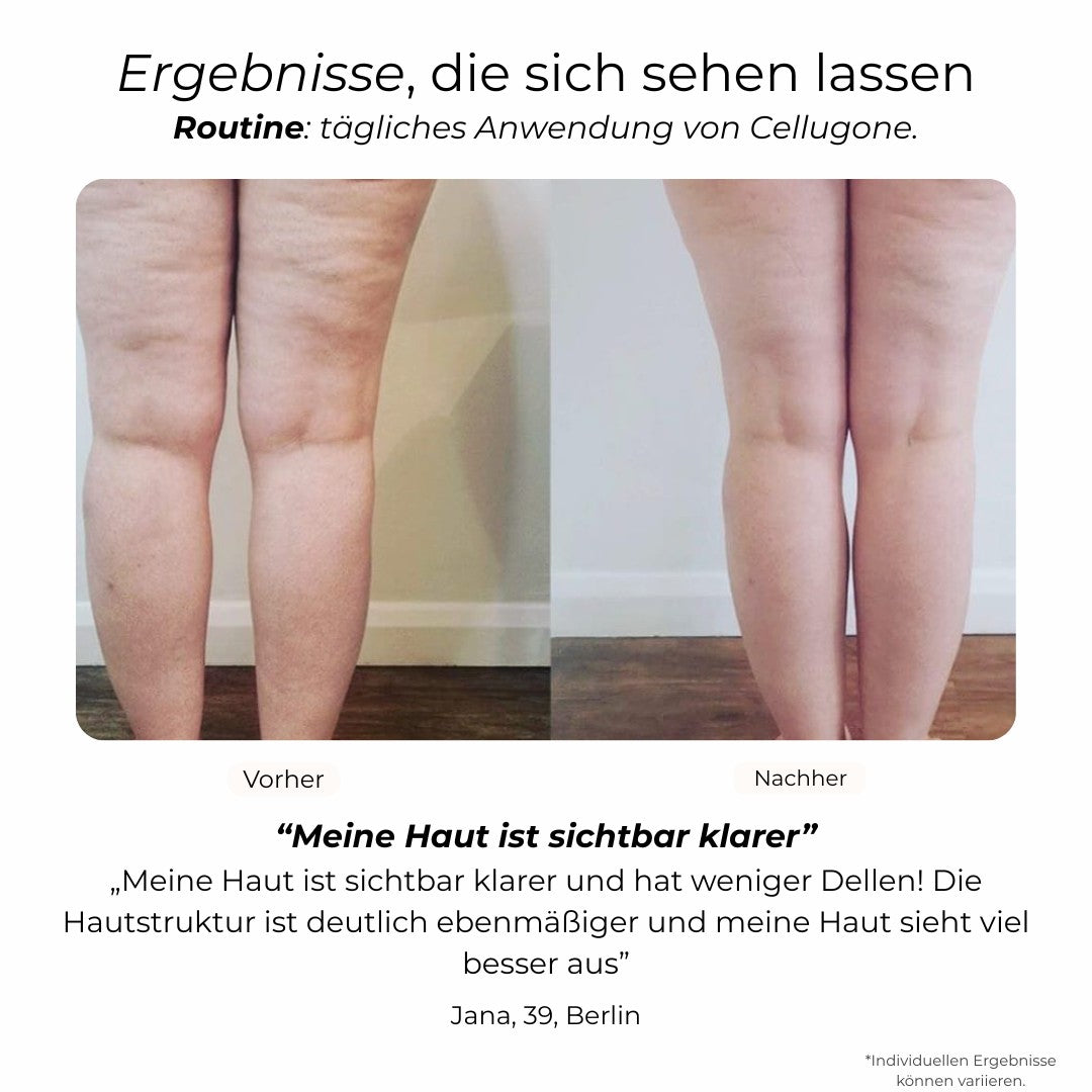 Cellugone 3.0: Glättet Cellulite und strafft Bauch, Beine & Po für zuhause
