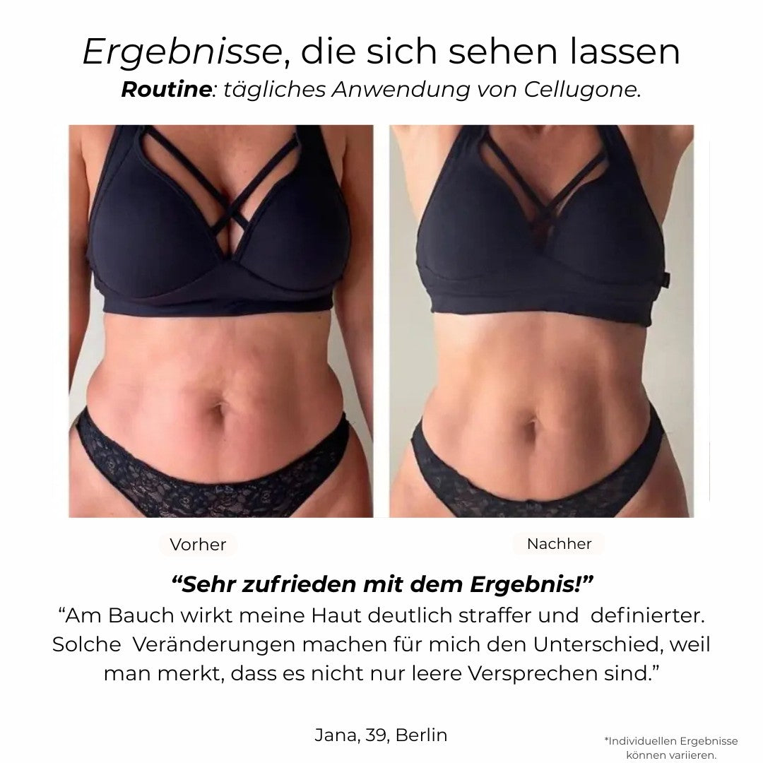 Cellugone 3.0: Glättet Cellulite und strafft Bauch, Beine & Po für zuhause
