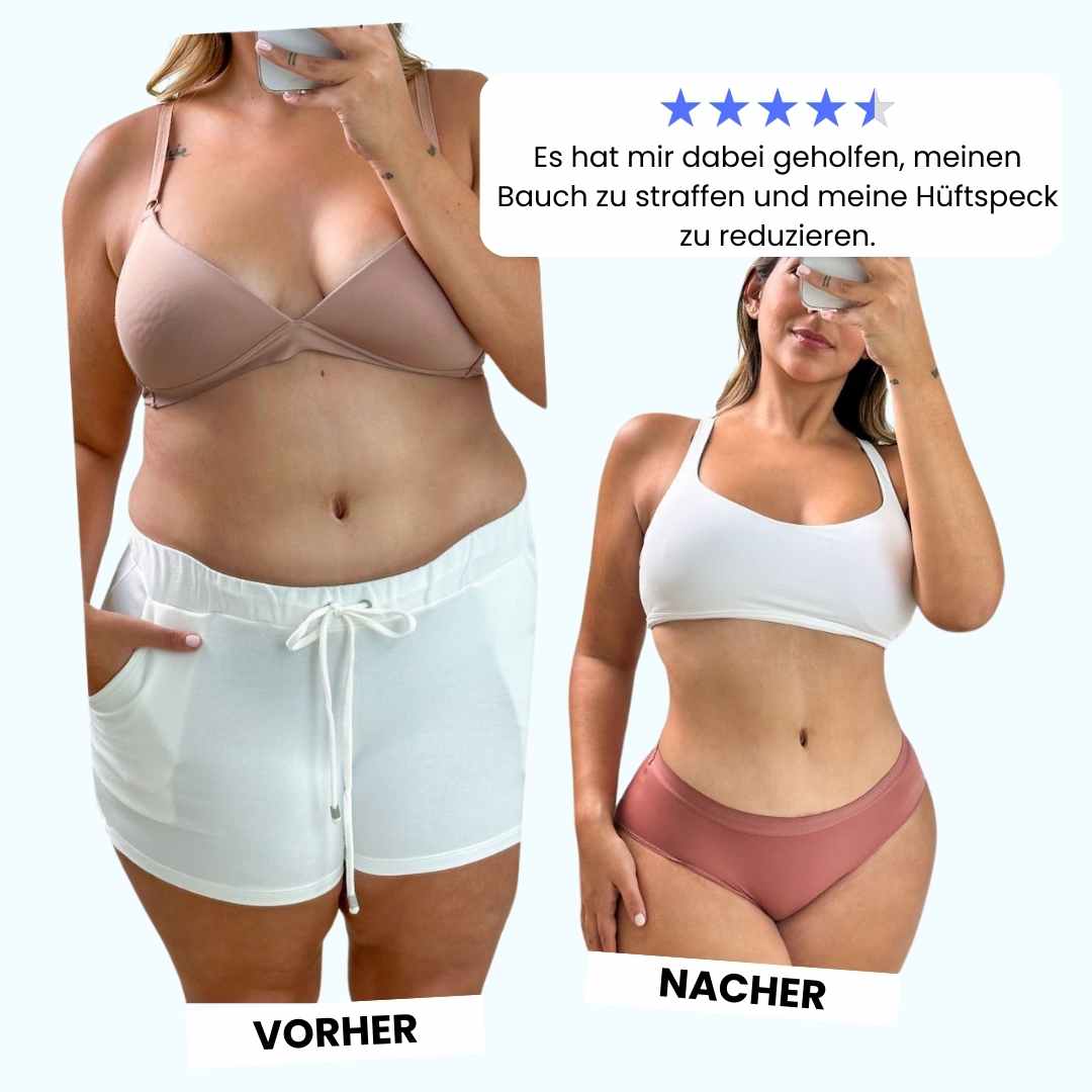 Cellugone 3.0: Glättet Cellulite und strafft Bauch, Beine & Po für zuhause