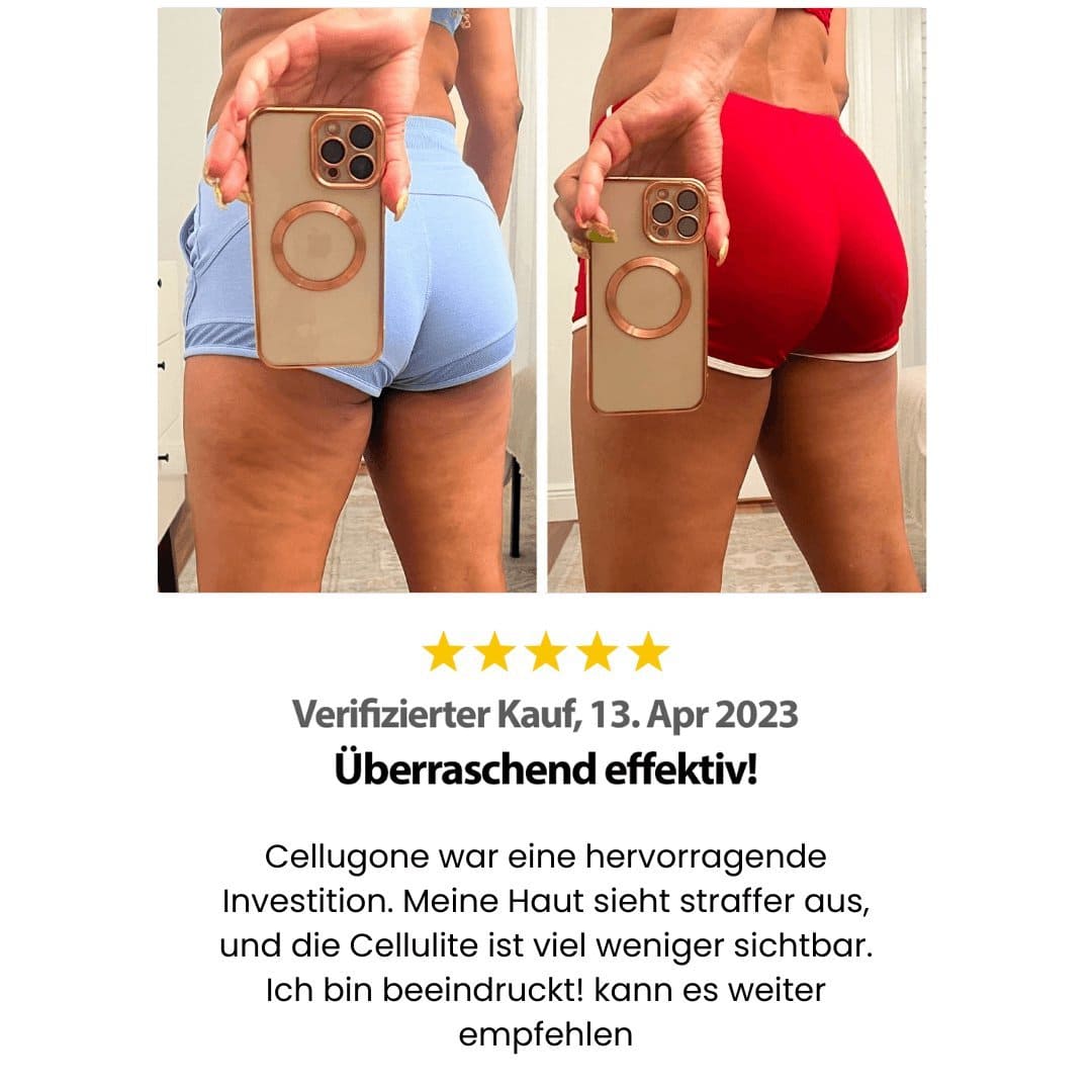 Cellugone 2.0 - INFRAROT MASSAGE Gerät