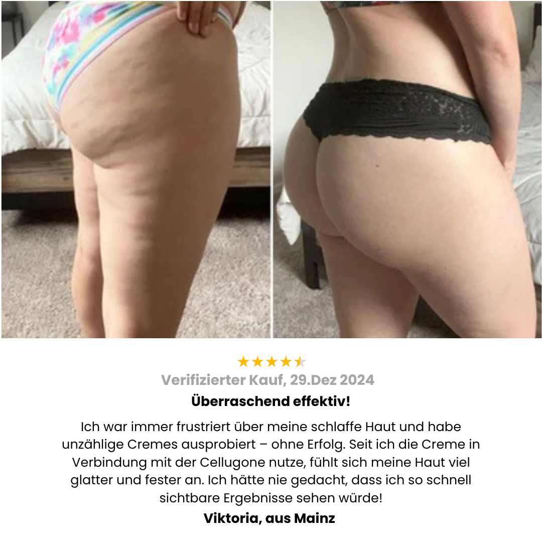 Cellugone 3.0 - Dein Selfcare Massage Gerät