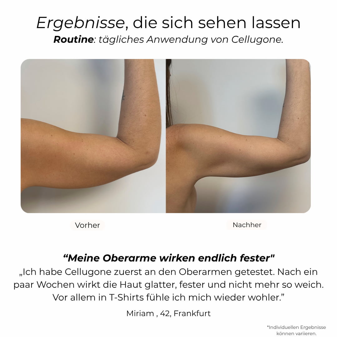 Cellugone 3.0: Sichtbar straffe Oberarme & glatte Haut für zuhause