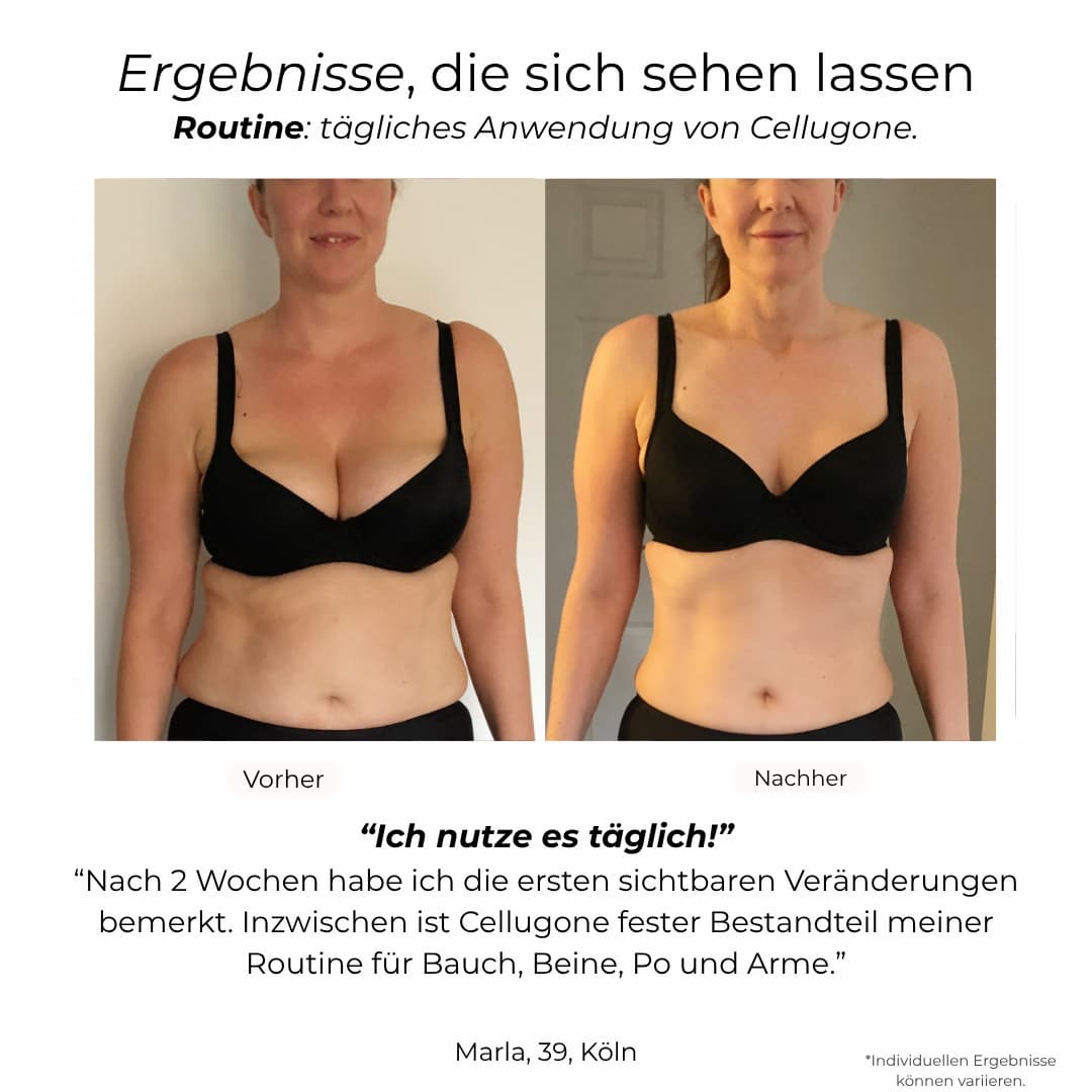 Cellugone 3.0: Sichtbar straffe Oberarme & glatte Haut für zuhause